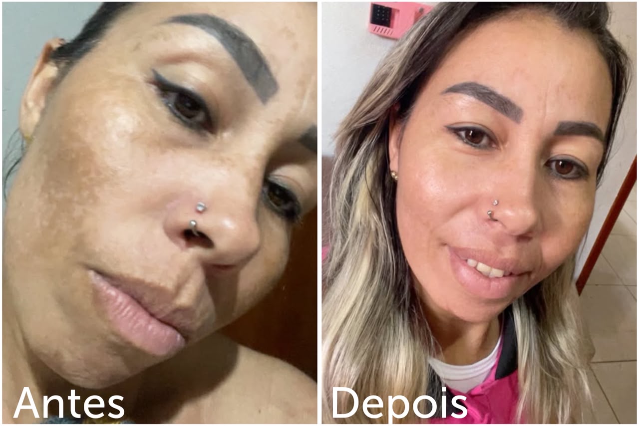 Foto comparativa com os rótulos Antes e Depois
